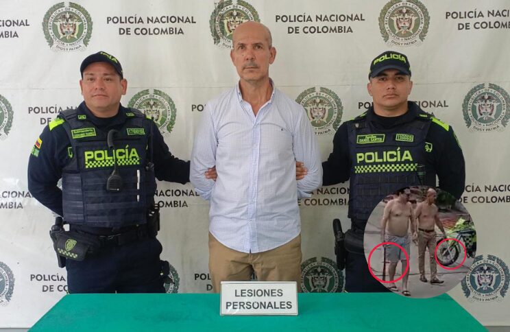¡Brutal ataque en Barranquilla! Técnico de Air-e fue golpeado con garrote y machete